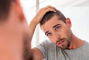 20-ways-to-stop-hair-loss-in-men-300x204 Symptoms of Alopecia, Causes and Treatment